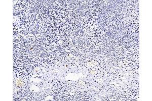 Immunohistochemistry analysis of paraffin-embedded Human amygdalitis using ITGAX Polyclonal Antibody at dilution of 1:200.