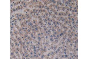 Used in DAB staining on fromalin fixed paraffin- embedded liver tissue (Paxillin 抗体  (AA 327-568))