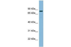 WB Suggested Anti-EPB41 Antibody Titration:  0. (EPB41 抗体  (N-Term))