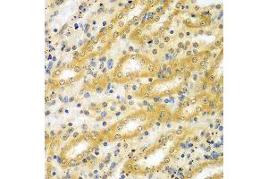 Immunohistochemistry of paraffin-embedded mouse kidney using ADCK3 antibody at dilution of 1:100 (x40 lens). (COQ8A 抗体)