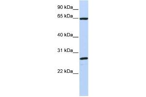 WB Suggested Anti-DNAJC1 Antibody Titration:  0.