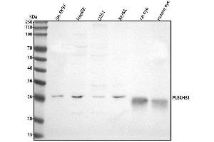 Western blot analysis of PLEKHB1 using anti-PLEKHB1 antibody (ABIN7602533).