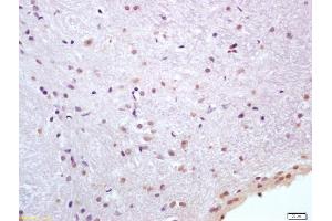 Formalin-fixed and paraffin embedded rat brain labeled with Anti-HSP70/HSPA1A Polyclonal Antibody, Unconjugated (ABIN1387822) at 1:200 followed by conjugation to the secondary antibody and DAB staining (HSP70 1A/ 1B (AA 500-600) 抗体)