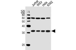 All lanes : Anti-EXOSC6 Antibody (N-term) at 1:1000 dilution Lane 1: Jurkat whole cell lysate Lane 2: WiDr whole cell lysate Lane 3: Hela whole cell lysate Lane 4: K562 whole cell lysate Lysates/proteins at 20 μg per lane. (EXOSC6 抗体  (N-Term))