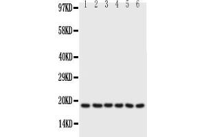 Anti-PLN antibody, Western blottingAll lanes: Anti PLN  at 0. (Phospholamban 抗体  (N-Term))