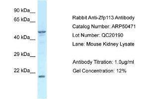 WB Suggested Anti-Zfp113 Antibody   Titration: 1. (Zfp113 抗体  (Middle Region))