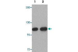Western blot analysis of mouse liver tissue with CDC27 polyclonal antibody  at (Lane 1) 1 and (Lane 2) 2 ug/mL dilution. (CDC27 抗体  (C-Term))