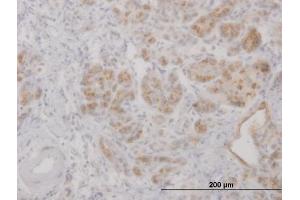 Immunoperoxidase of purified MaxPab antibody to LCN2 on formalin-fixed paraffin-embedded human pancreas. (Lipocalin 2 抗体  (AA 1-198))