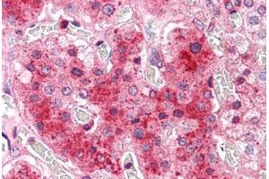 Human Adrenal: Formalin-Fixed, Paraffin-Embedded (FFPE) (COMT 抗体  (N-Term))