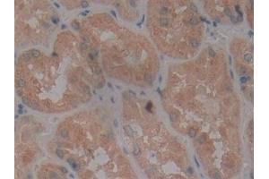 Immunohistochemistry (IHC) image for anti-CD40 (CD40) (AA 26-187) antibody (ABIN7442747)