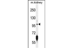 Western blot analysis in mouse kidney tissue lysates (35ug/lane). (CARNS1 抗体  (N-Term))