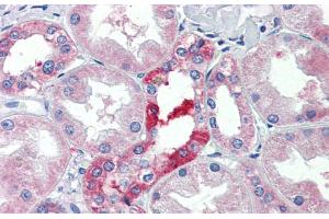Immunohistochemistry with Human kidney lysate tissue at an antibody concentration of 5. (SLC25A28 抗体  (C-Term))