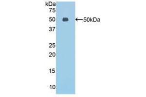Western blot analysis of recombinant Mouse ESM1. (ESM1 抗体  (AA 22-184))