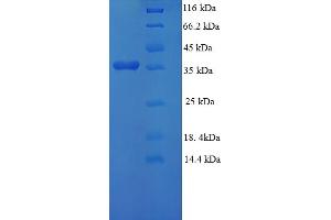 SDS-PAGE (SDS) image for gamma-Glutamylcyclotransferase (GGCT) (AA 1-188), (full length) protein (His-SUMO Tag) (ABIN5709573)