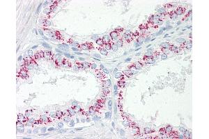 Anti-CPEB3 antibody IHC of human prostate. (CPEB3 抗体  (AA 324-373))