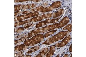 Immunohistochemical staining of human stomach with ALG13 polyclonal antibody  shows strong cytoplasmic positivity in glandular cells. (ALG13 抗体)