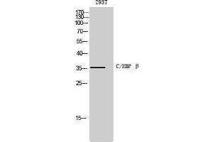 Western Blotting (WB) image for anti-CCAAT/enhancer Binding Protein (C/EBP), beta (CEBPB) (Ser243) antibody (ABIN3174087) (CEBPB 抗体  (Ser243))