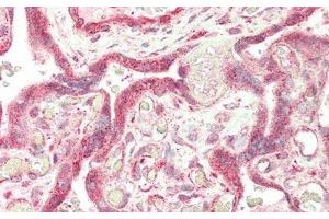 Detection of FUR in Human Placenta Tissue using Polyclonal Antibody to Furin (FUR) (FURIN 抗体  (AA 385-500))