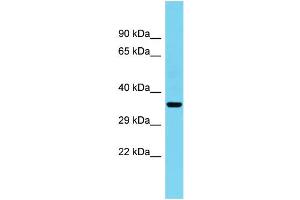 Host: Rabbit Target Name: C1orf222 Sample Type: Fetal Heart lysates Antibody Dilution: 1. (CFAP74/KIAA1751 抗体  (C-Term))