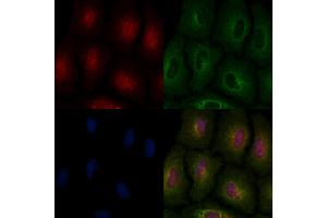 ABIN6263071 and ABIN6266879 staining  cells by IF/ICC. (Melanoma Antigen Family D, 4 (MAGED4) (C-Term) 抗体)