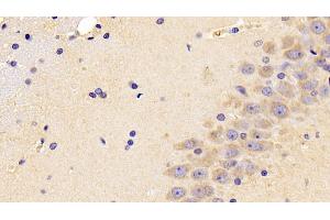 Detection of PEDF in Rat Cerebrum Tissue using Polyclonal Antibody to Pigment Epithelium Derived Factor (PEDF) (PEDF 抗体  (AA 20-418))