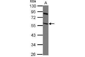 WB Image Sample (30 ug of whole cell lysate) A: K562 10% SDS PAGE antibody diluted at 1:1000 (SIRPG 抗体)