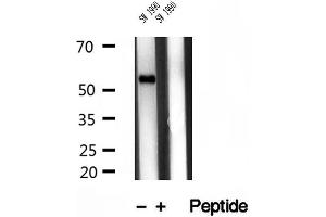 Western blot analysis of extracts of SW 1990 cells, using TMPRSS4 antibody. (TMPRSS4 抗体  (Internal Region))