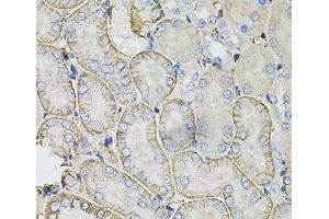 Immunohistochemistry of paraffin-embedded Mouse kidney using SLC4A4 / NBC Polyclonal Antibody at dilution of 1:100 (40x lens). (SLC4A4 抗体)