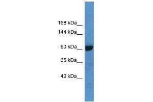 WB Suggested Anti-ABCC4 Antibody Titration: 1. (ABCC4 抗体  (C-Term))