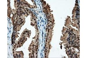Immunohistochemical staining of paraffin-embedded liver tissue using anti-CUGBP1 mouse monoclonal antibody. (CELF1 抗体)