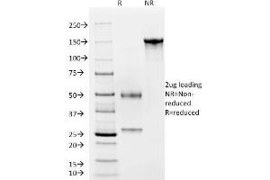 SDS-PAGE Analysis Purified vWF Recombinant Mouse Monoclonal Antibody (rVWF/2480). (Recombinant VWF 抗体)
