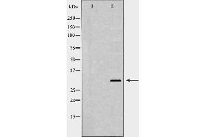 Western blot analysis of extracts of HEK-293, using XPA antibody. (XPA 抗体  (Internal Region))