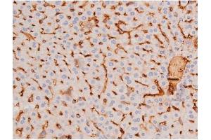 Immunohistochemistry (IHC) image for anti-Mast/stem Cell Growth Factor Receptor (KIT) (pTyr703) antibody (ABIN6255994)