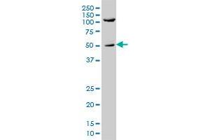 SHC1 monoclonal antibody (M01), clone 3F4 Western Blot analysis of SHC1 expression in A-431 .