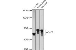 Western Blotting (WB) image for anti-Glutamate Decarboxylase 2 (Pancreatic Islets and Brain, 65kDa) (GAD2) (AA 401-585) antibody (ABIN3021188)