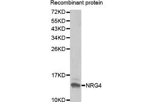 Western Blotting (WB) image for anti-Neuregulin 4 (NRG4) antibody (ABIN1873958) (Neuregulin 4 抗体)