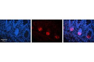 Rabbit Anti-TMEM26 Antibody Catalog Number: ARP71768_P050 Formalin Fixed Paraffin Embedded Tissue: Human Human Colon Tissue Observed Staining: Plasma membrane, Cytoplasm Primary Antibody Concentration: 1:100 Other Working Concentrations: 1:600 Secondary Antibody: Donkey anti-Rabbit-Cy3 Secondary Antibody Concentration: 1:200 Magnification: 20X Exposure Time: 0. (TMEM26 抗体  (C-Term))
