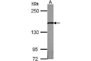 WB Image Sample (30 ug of whole cell lysate) A:NIH-3T3 5% SDS PAGE antibody diluted at 1:1000 (AUTS2 抗体  (Internal Region))