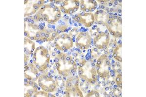 Immunohistochemistry of paraffin-embedded mouse liver using HADH antibody. (HADH 抗体)