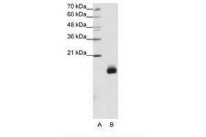 Image no. 1 for anti-Ribosomal Protein S14 (RPS14) (N-Term) antibody (ABIN203013) (RPS14 抗体  (N-Term))