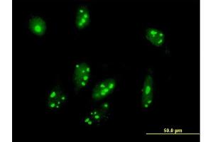 Immunofluorescence of purified MaxPab antibody to C1orf87 on HeLa cell. (C1orf87 抗体  (AA 1-546))