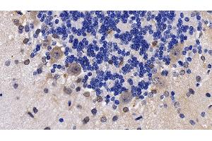 Detection of NPS in Rat Cerebellum Tissue using Polyclonal Antibody to Neuropeptide S (NPS) (NPS 抗体  (AA 26-89))