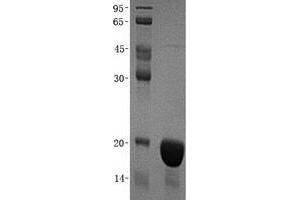 Western Blotting (WB) image for Cyclin-Dependent Kinase Inhibitor 2C (p18, Inhibits CDK4) (CDKN2C) (Transcript Variant 1) protein (His tag) (ABIN2713882)