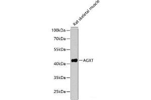 Western blot analysis of extracts of Rat skeletal muscle using AGXT Polyclonal Antibody at dilution of 1:1000. (AGXT 抗体)