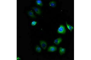 Immunofluorescence staining of A549 cells with ABIN7169933 at 1:100, counter-stained with DAPI. (SCN1B 抗体  (AA 44-156))