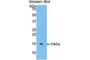 Western blot analysis of the recombinant protein. (UCP1 抗体  (AA 179-296))