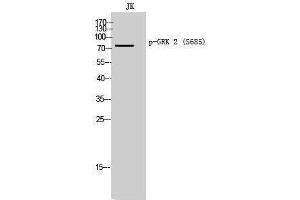 Western Blotting (WB) image for anti-Adrenergic, Beta, Receptor Kinase 1 (ADRBK1) (pSer685) antibody (ABIN3173109) (GRK2 抗体  (pSer685))