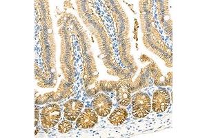 Immunohistochemistry analysis of paraffin-embedded mouse small intestine using LI Cadherin (ABIN7074493) at dilution of 1: 1500