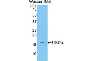 Western Blotting (WB) image for anti-ADAM Metallopeptidase with Thrombospondin Type 1 Motif, 7 (ADAMTS7) (AA 226-437) antibody (ABIN3205719) (ADAMTS7 抗体  (AA 226-437))