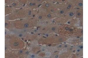 Detection of FTH in Human Liver Tissue using Polyclonal Antibody to Ferritin, Heavy Polypeptide (FTH) (FTH1 抗体  (AA 1-183))